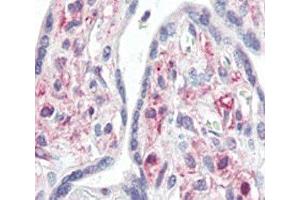 IHC analysis of FFPE human placenta tissue stained with IRAK antibody