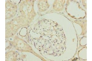 Immunohistochemistry of paraffin-embedded human kidney tissue using ABIN7170672 at dilution of 1:100 (SLA antibody  (AA 2-276))