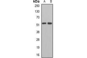 Western blot analysis of MPP1 expression in Jurkat (A), mouse kidney (B) whole cell lysates. (MPP1 antibody)
