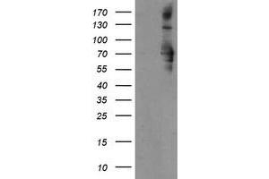 HEK293T cells were transfected with the pCMV6-ENTRY control (Left lane) or pCMV6-ENTRY SENP2 (Right lane) cDNA for 48 hrs and lysed. (SENP2 antibody  (AA 139-523))