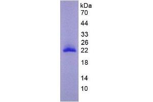 Image no. 2 for Matrix Metallopeptidase 9 (Gelatinase B, 92kDa Gelatinase, 92kDa Type IV Collagenase) (MMP9) (AA 225-413) protein (His tag) (ABIN1980762) (MMP 9 Protein (AA 225-413) (His tag))