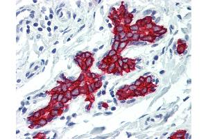 Anti-Cytokeratin 19 antibody IHC of human breast. (Cytokeratin 19 antibody)