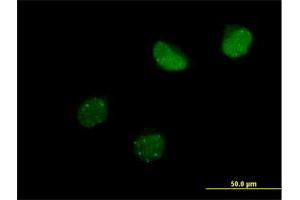 Immunofluorescence of purified MaxPab antibody to SUMO4 on HeLa cell. (SUMO4 antibody  (AA 1-95))