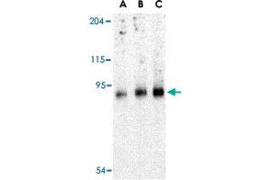 Western blot analysis of TRPC6 in mouse lung tissue lysate with TRPC6 polyclonal antibody  at (A) 0. (TRPC6 antibody  (C-Term))