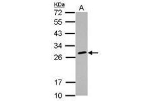 Image no. 2 for anti-Major Histocompatibility Complex, Class II, DQ beta 2 (HLA-DQB2) antibody (ABIN1498674) (HLA-DQB2 antibody)