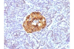 Immunohistochemistry (IHC) image for anti-Chromogranin A (CHGA) antibody (ABIN6939135)