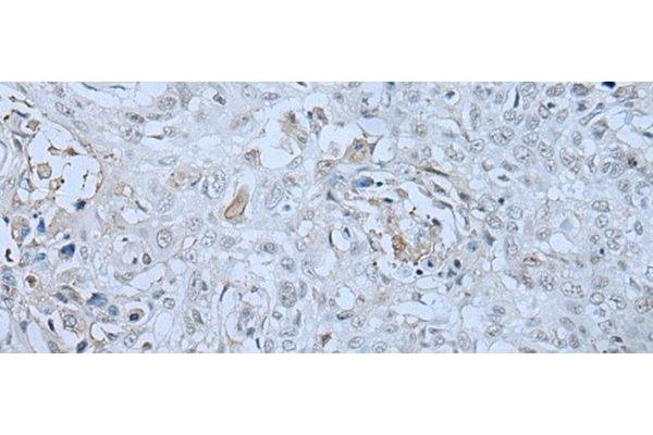 HUWE1 antibody