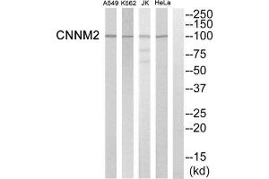 Western blot analysis of extracts from Hela cells, K562 cells, Jurkat cells and A549 cells, using CNNM2 antibody. (Cyclin M2 antibody  (Internal Region))