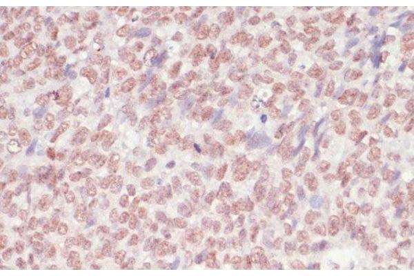 SNRNP70 antibody