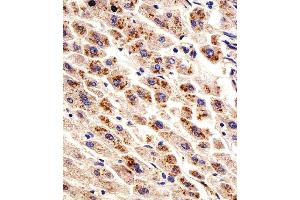 Immunohistochemical analysis of paraffin-embedded H. (Dihydrofolate Reductase antibody  (N-Term))