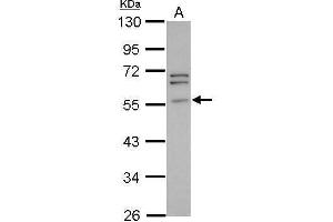 WB Image Sample (30 ug of whole cell lysate) A: PC-3 10% SDS PAGE antibody diluted at 1:1000 (Peripherin antibody)
