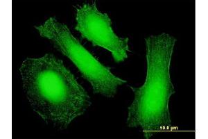 Immunofluorescence of purified MaxPab antibody to LIN28 on HeLa cell. (LIN28A antibody  (AA 1-209))