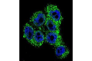 Confocal immunofluorescent analysis of TRPM8 Antibody (Center) with A375 cell followed by Alexa Fluor 488-conjugated goat anti-rabbit lgG (green). (TRPM8 antibody  (Middle Region))