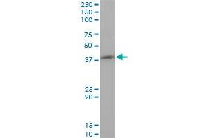 STYK1 monoclonal antibody (M02), clone 3D2. (STYK1 antibody  (AA 50-159))