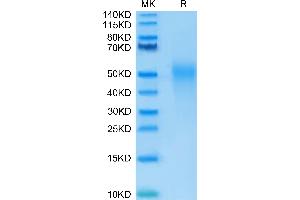 Human IL-18BP on Tris-Bis PAGE under reduced condition. (IL18BP Protein (AA 31-194) (His tag))