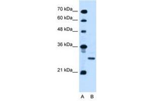 Image no. 1 for anti-Podoplanin (PDPN) (AA 97-146) antibody (ABIN6736674) (Podoplanin antibody  (AA 97-146))