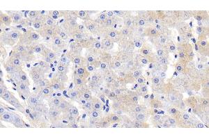 Detection of FGA in Bovine Liver Tissue using Polyclonal Antibody to Fibrinogen Alpha Chain (FGA) (FGA antibody  (AA 39-615))