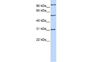 WB Suggested Anti-RAI14 Antibody Titration: 0. (RAI14 antibody  (Middle Region))