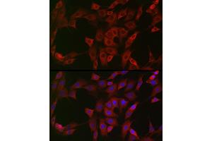 Immunofluorescence (IF) image for anti-NAD(P)H Dehydrogenase, Quinone 1 (NQO1) (AA 1-274) antibody (ABIN1681096)