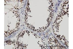 Image no. 3 for anti-PDZ Binding Kinase (PBK) (AA 1-110) antibody (ABIN599275) (PBK antibody  (AA 1-110))
