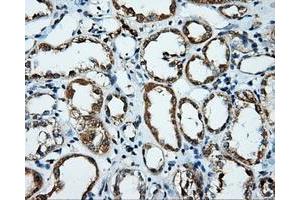 Immunohistochemical staining of paraffin-embedded Kidney tissue using anti-PLEK mouse monoclonal antibody. (Pleckstrin antibody)