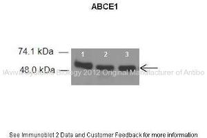 Researcher: Dr. (ABCE1 antibody  (C-Term))