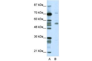 WB Suggested Anti-CORO1A  Antibody Titration: 2. (Coronin 1a antibody  (N-Term))