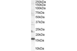 Image no. 1 for anti-SH2 Domain Containing 1A (SH2D1A) (Internal Region) antibody (ABIN374629)
