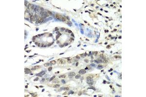 Immunohistochemistry (Paraffin-embedded Sections) (IHC (p)) image for anti-Hypoxia Inducible Factor 1, alpha Subunit Inhibitor (HIF1AN) (AA 1-349) antibody (ABIN6141762)