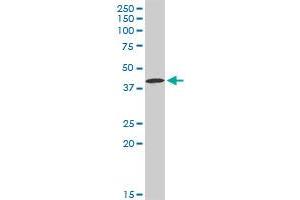 CA12 MaxPab rabbit polyclonal antibody. (CA12 antibody  (AA 1-354))