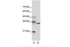 Image no. 1 for anti-Hairy and Enhancer of Split 4 (HES4) (N-Term) antibody (ABIN202082)