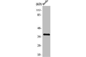 Western Blot analysis of MCF7 cells using TIS11B Polyclonal Antibody (ZFP36L1 antibody)