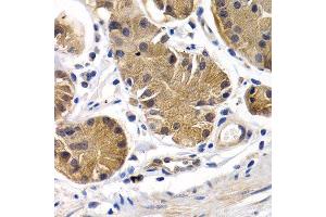 Immunohistochemistry (Paraffin-embedded Sections) (IHC (p)) image for anti-Prostacyclin Receptor (PTGIR) (AA 207-386) antibody (ABIN3015619)