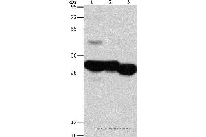 Western blot analysis of Mouse liver and kidney tissue, human fetal liver tissue, using KHK Polyclonal Antibody at dilution of 1:1250 (Ketohexokinase antibody)