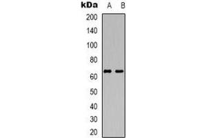 Western blot analysis of DCP1A expression in HuvEc (A), Jurkat (B) whole cell lysates. (DCP1A antibody)