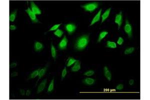 Immunofluorescence of monoclonal antibody to TESK2 on HeLa cell. (TESK2 antibody  (AA 405-542))