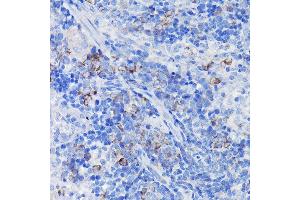 Immunohistochemistry of paraffin-embedded rat spleen using Clusterin alpha chain Rabbit pAb (ABIN6133477, ABIN6138756, ABIN6138758 and ABIN6216721) at dilution of 1:100 (40x lens). (Clusterin antibody  (AA 23-120))
