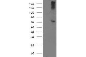 HEK293T cells were transfected with the pCMV6-ENTRY control (Left lane) or pCMV6-ENTRY ATP6V1B1 (Right lane) cDNA for 48 hrs and lysed. (ATP6V1B1 antibody)