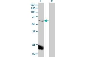 Western Blot analysis of PPARBP expression in transfected 293T cell line by PPARBP monoclonal antibody (M01), clone 2A2. (MED1 antibody  (AA 1391-1490))