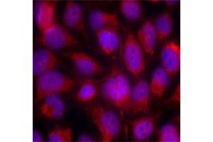 Immunofluorescence staining of methanol-fixed HeLa cells using MAP3K5 polyclonal antibody . (ASK1 antibody)
