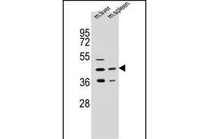 AWAT2 Antibody (C-term) (ABIN654780 and ABIN2844461) western blot analysis in mouse liver,spleen tissue lysates (35 μg/lane). (AWAT2 antibody  (C-Term))