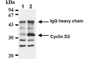 Western Blotting (WB) image for anti-Cyclin D2 (CCND2) antibody (ABIN487478) (Cyclin D2 antibody)