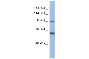 WB Suggested Anti-CIZ1  Antibody Titration: 0. (CIZ1 antibody  (Middle Region))