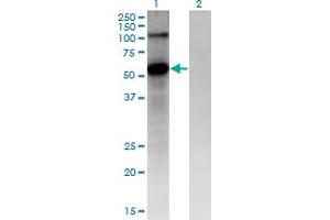 Western Blot analysis of FZD4 expression in transfected 293T cell line by FZD4 monoclonal antibody (M02), clone 3G7. (FZD4 antibody  (AA 107-206))
