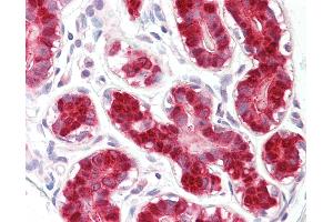 Anti-RIG-1 / RIG-I antibody IHC of human breast. (DDX58 antibody  (AA 200-250))