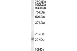 ABIN238604 (1µg/ml) staining of Jurkat cell lysate (35µg protein in RIPA buffer). (ASF1A antibody  (C-Term))
