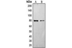 Western blot analysis of Frizzled 6 expression in HT29 (A), HeLa (B) whole cell lysates.