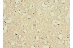 Immunohistochemistry of paraffin-embedded human brain tissue using ABIN7142540 at dilution of 1:100