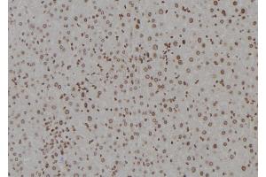 ABIN6277358 at 1/100 staining Mouse liver tissue by IHC-P. (DDB1 antibody  (C-Term))