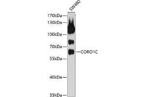 Western blot analysis of extracts of SW480 cells, using CORO1C antibody (ABIN1679327, ABIN3019058, ABIN3019059 and ABIN6220690) at 1:1000 dilution. (CORO1C antibody  (AA 375-474))
